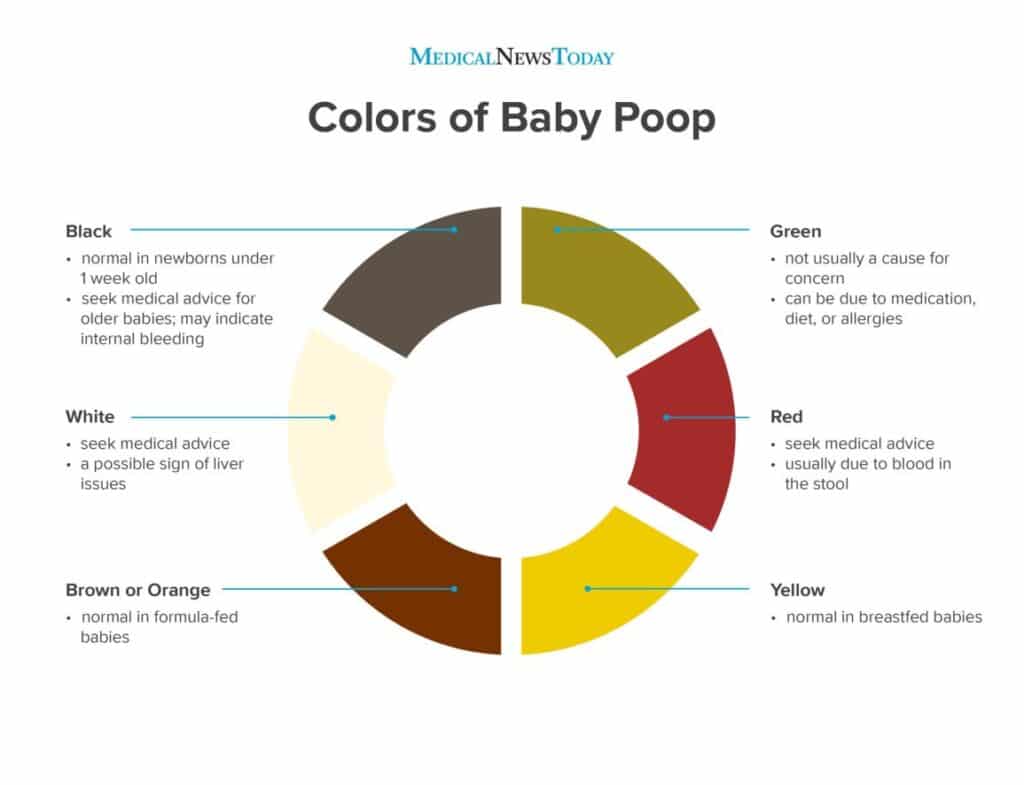 Baby poop color chart showing normal and abnormal stool colors for newborns.