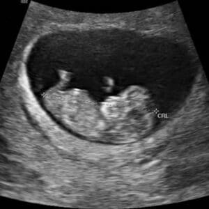 prenatal questions